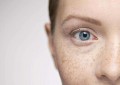 怎样预防色斑（预防脸上长斑的五个方法）
