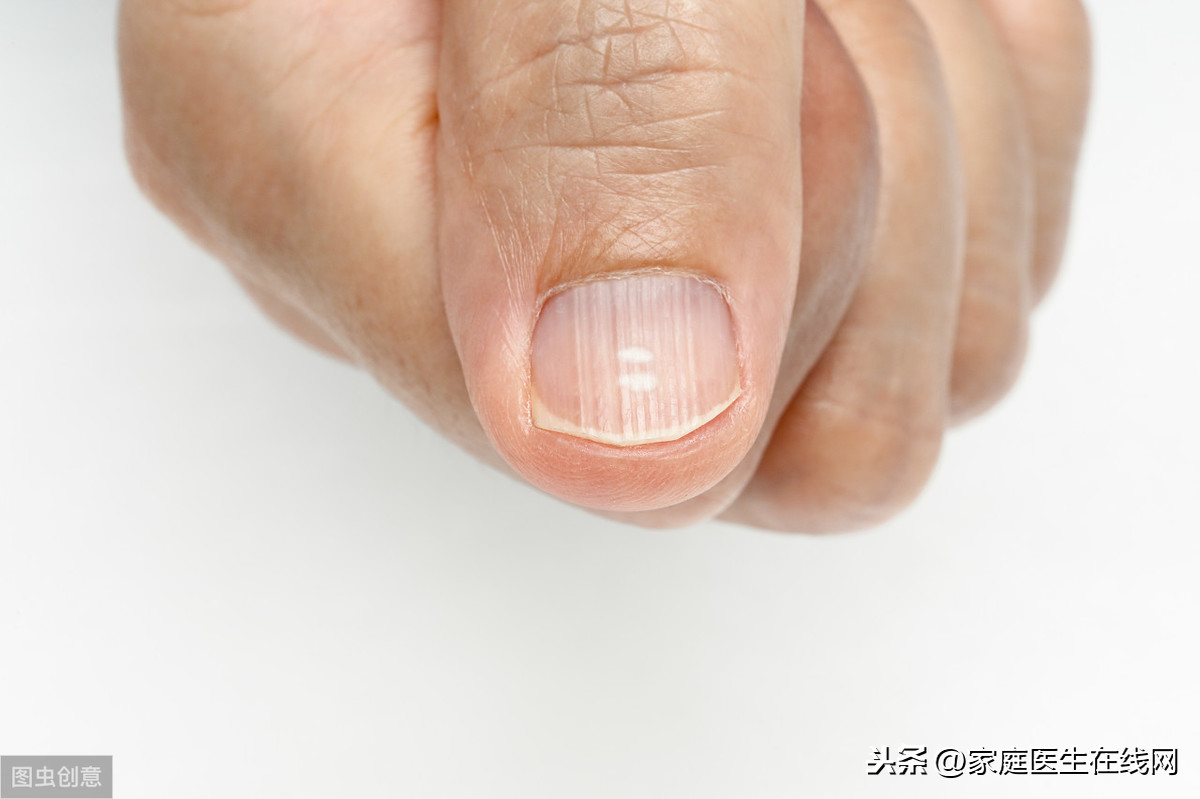 啃了十几年的指甲 留长能恢复正常的指甲吗? - 知乎