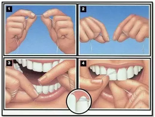 如何正确刷牙（刷牙的正确步骤顺序）