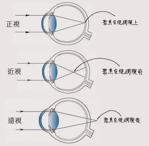 凹透镜成像规律（凹透镜成像的原理及常见问题）