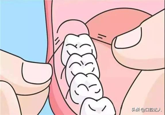 一次性牙线的使用方法（牙医告诉你使用牙线的正确姿势）